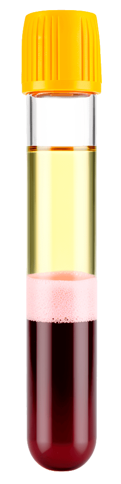 Selphyl PRP tube showing separated blood layers