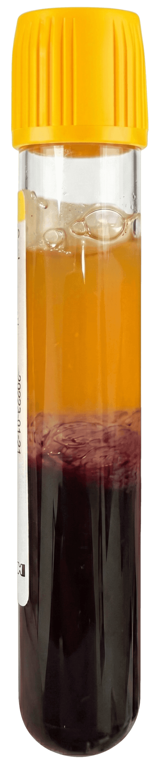 Selphyl Centrifuge Tube showing separated LP-PRP layers