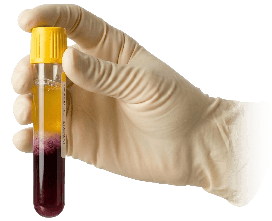 PRP therapy visualization