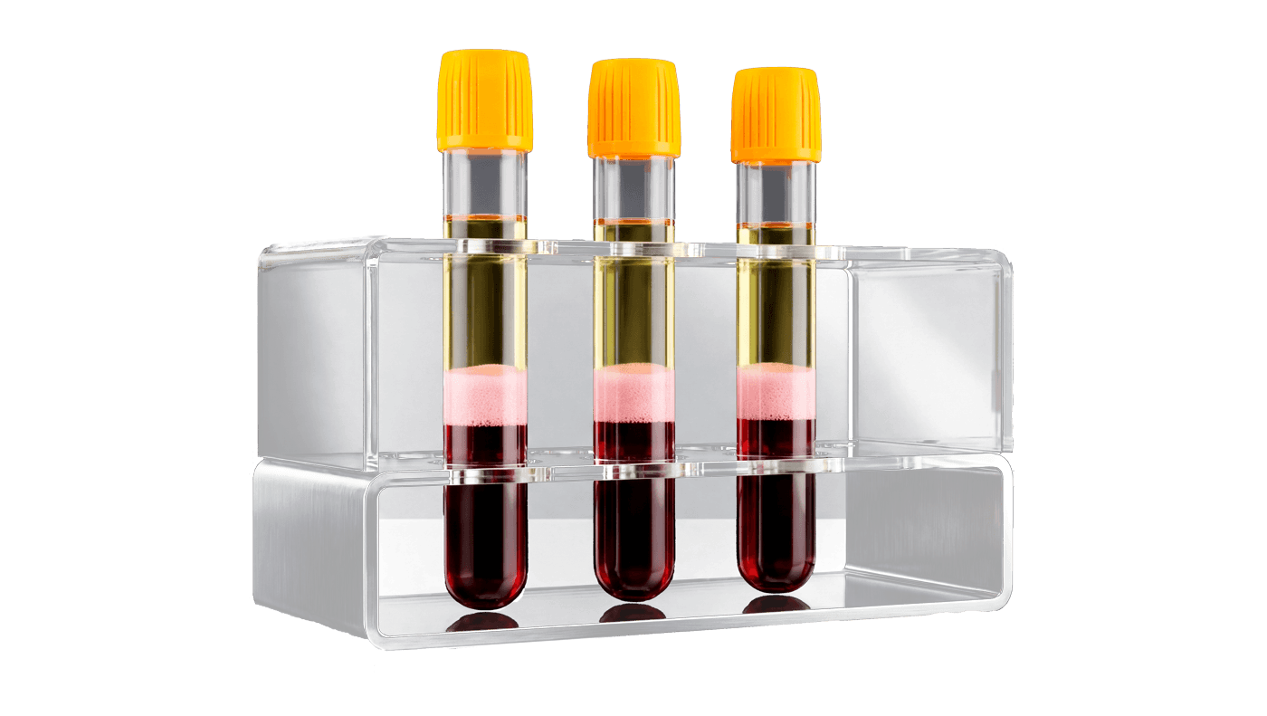 PRP therapy visualization