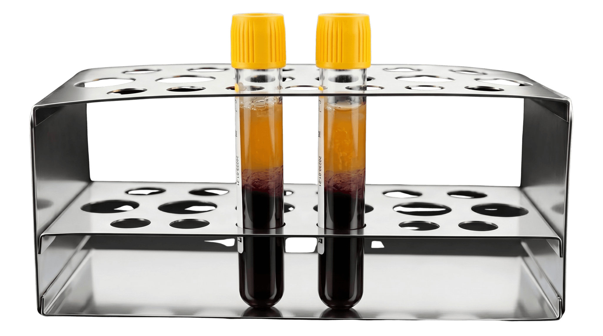 PRP therapy visualization